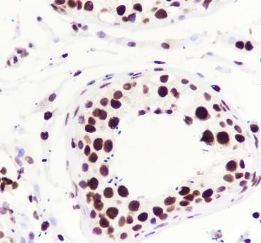 Recombinant ILF3 Monoclonal Antibody - small - 4