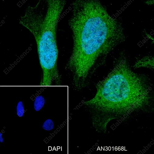 Recombinant SOD1 Monoclonal Antibody - 5