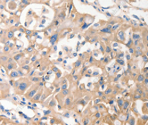 MVP Polyclonal Antibody - 2