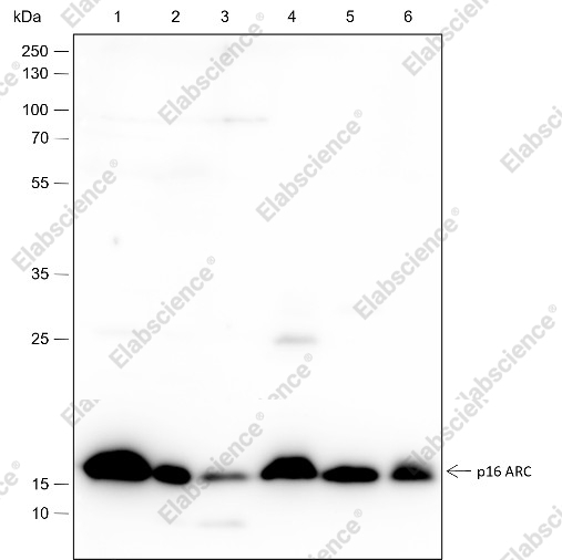 Recombinant ARPC5/p16 ARC Monoclonal Antibody - 1
