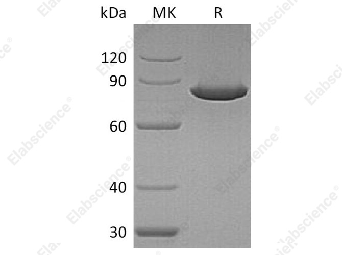 Recombinant Human Ezrin/EZR Protein - 1