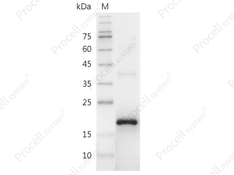 FGF-2/bFGF/FGF-basic, Swine, Recombinant