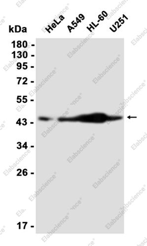 Recombinant NR2F2 Monoclonal Antibody - 1