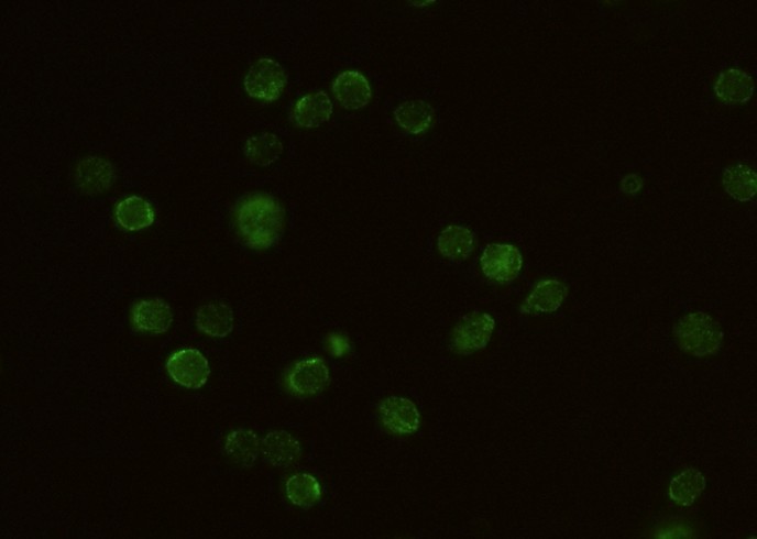 Recombinant CD132/IL2RG Monoclonal Antibody-searchlist-1