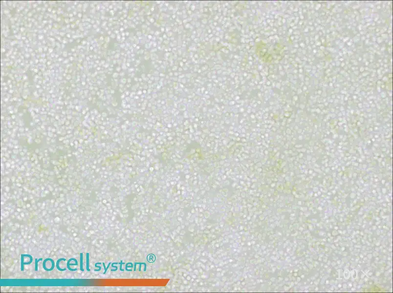 OKT 11 Cell Complete Medium - 1