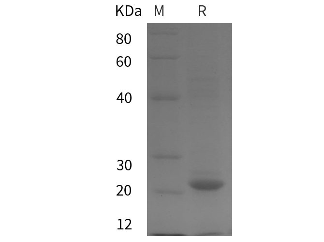 Recombinant Human CDH1 Protein(Trx Tag)-产品推荐-1