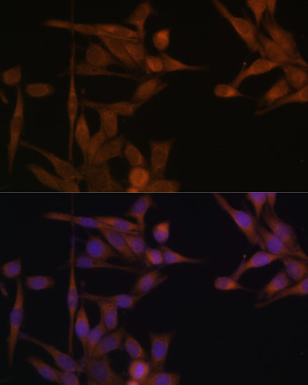 Immunofluorescence analysis of HeLa cells using PP2A Catalytic α Polyclonal Antibody at dilution of 1:100. Blue:DAPI for nuclear staining.