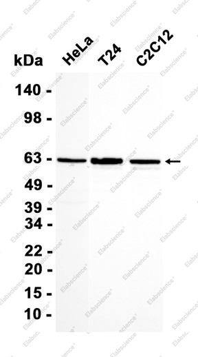Recombinant SMARCD2 Monoclonal Antibody - 1