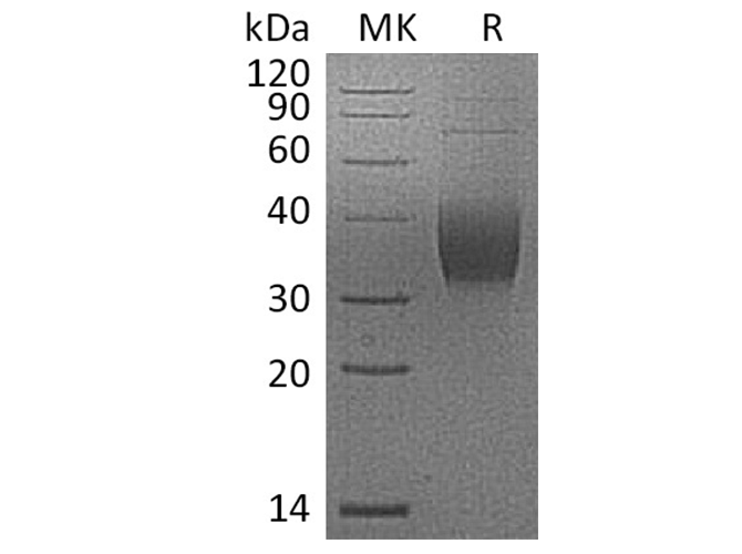 Recombinant Cynomolgus PD-L2/B7-DC/CD273 Protein (His Tag)