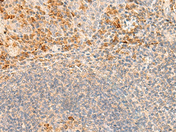 Immunohistochemistry of paraffin-embedded Human tonsil tissue  using GRM2 Polyclonal Antibody at dilution of 1:35(?200)