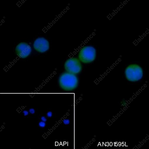 Recombinant MALT1/MLT Monoclonal Antibody - 2