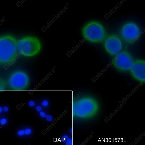 Recombinant Keratin 20 Monoclonal Antibody - 4