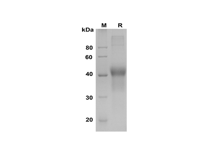 Recombinant Human M-CSF Protein(His Tag)-1