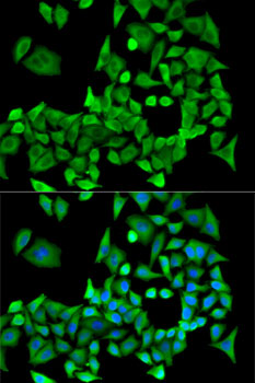 Immunofluorescence analysis of U2OS cells using PPP2R1A Polyclonal Antibody