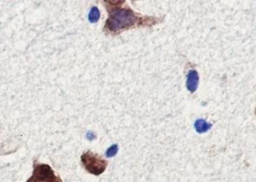 Recombinant eEF1A2 Monoclonal Antibody-searchlist-3