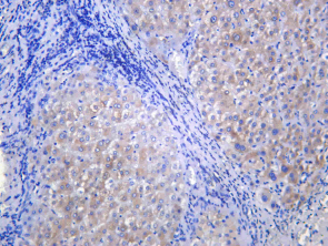Recombinant CYP2C19 Monoclonal Antibody - 1