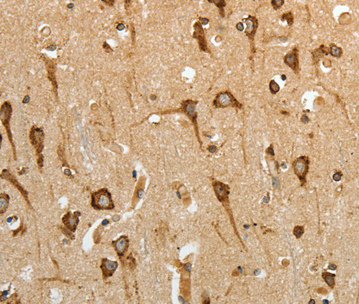 Immunohistochemistry of paraffin-embedded Human brain using HSP90B1 Polyclonal Antibody at dilution of 1:50