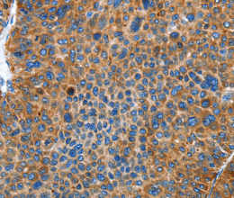 AUP1 Polyclonal Antibody - 2