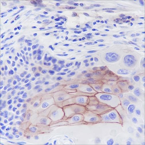 Recombinant Thrombomodulin Monoclonal Antibody-searchlist-1