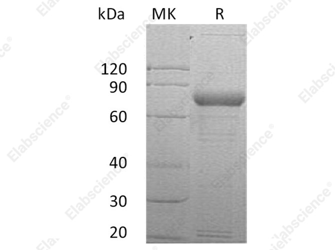 Recombinant Human SIRP gamma/CD172g Protein (Fc Tag) - 1