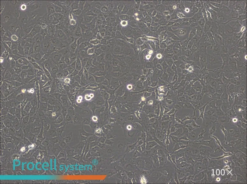 BT-549 Cell Complete Medium - 1