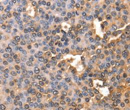 AFP Polyclonal Antibody - 2