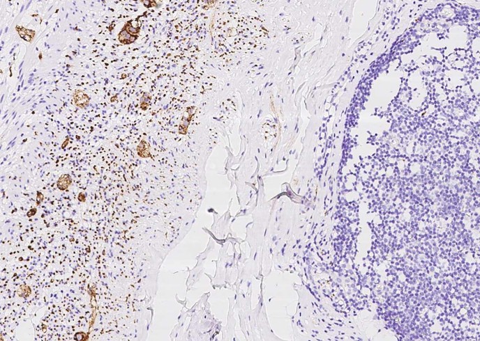 Recombinant Synaptophysin/SYP Monoclonal Antibody - small - 4