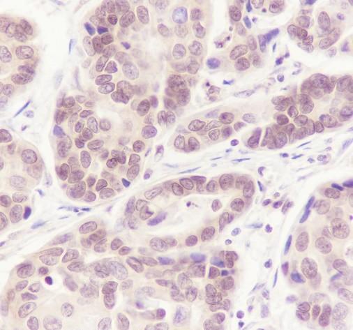Recombinant CSNK2A1 Monoclonal Antibody - small - 2