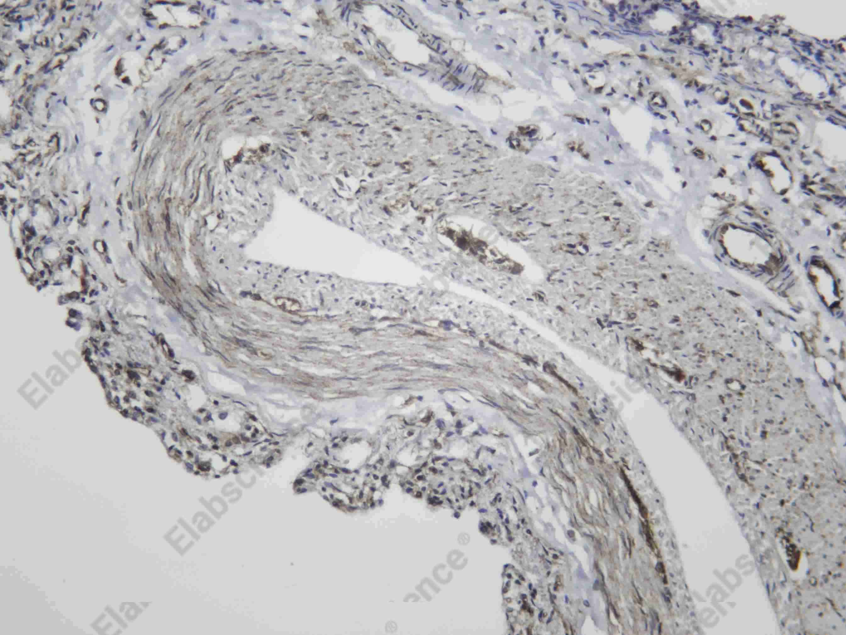 Recombinant Muscarinic Acetylcholine Receptor M2 Monoclonal Antibody - 3