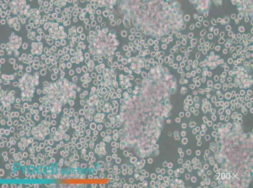 Granta-519 Cell Complete Medium - 6