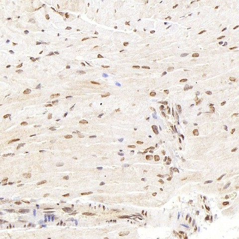 Immunohistochemistry analysis of paraffin-embedded mouse heart  using SMAD2 Polyclonal Antibody at dilution of 1:400.