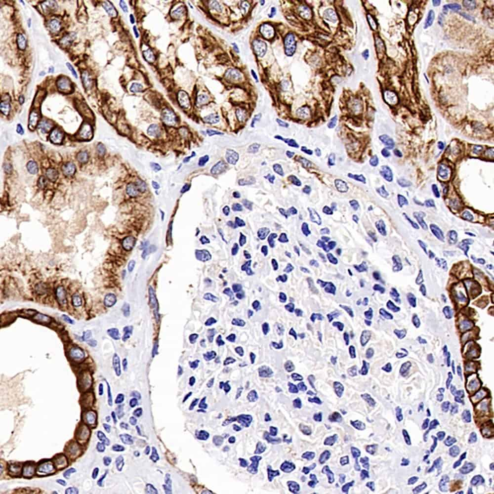 Immunohistochemistry analysis of paraffin-embedded human kidney  using CK-18 Polyclonal Antibody at dilution of 1:500.