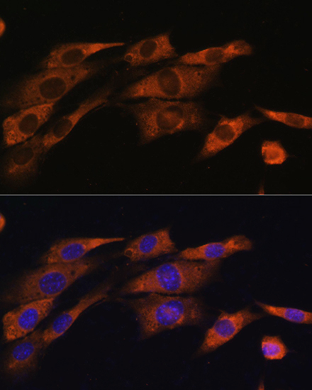 Immunofluorescence analysis of NIH/3T3 cells using ACHE Polyclonal Antibody at dilution of 1:100. Blue: DAPI for nuclear staining.