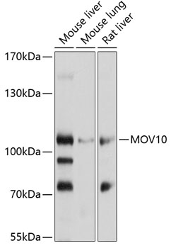 Western blot analysis of extracts of various cell lines using MOV10 Polyclonal Antibody at 1:1000 dilution.