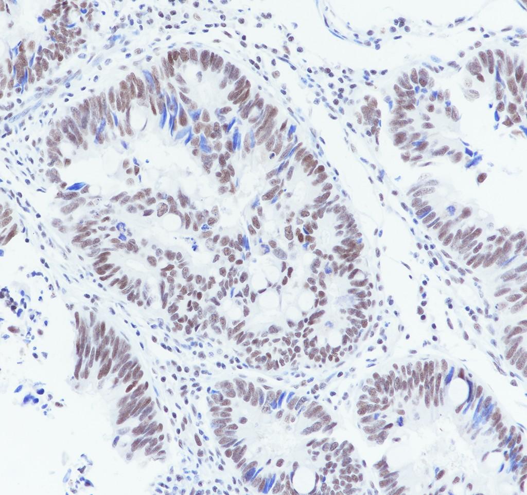 Recombinant NELF-B Monoclonal Antibody - 3