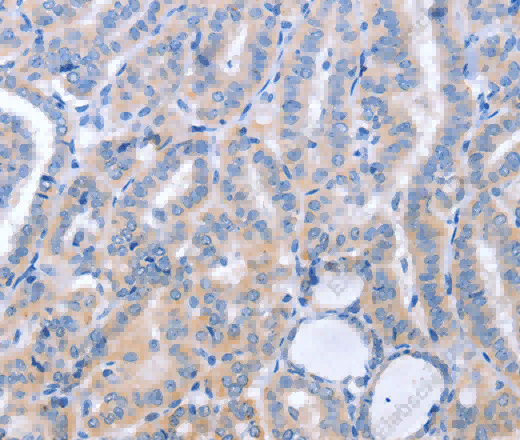 B3GAT1 Polyclonal Antibody - 2
