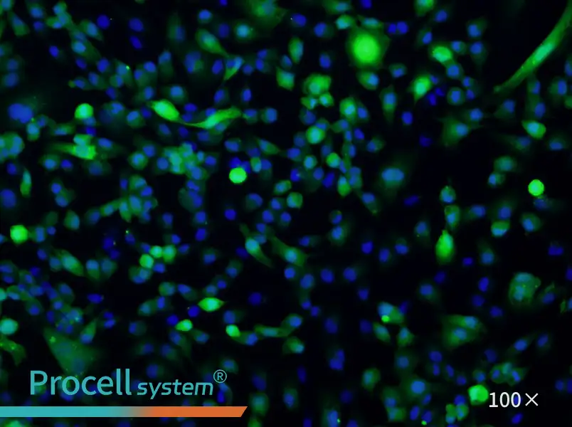 ACHN-GFP Cell Complete MediumACHN-GFP Cell Complete Medium - 2