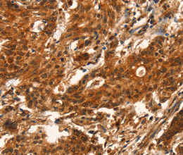 CUEDC2 Polyclonal Antibody - 3