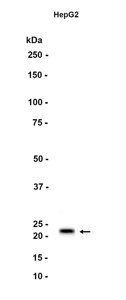 Recombinant RBP4 Monoclonal Antibody - 1