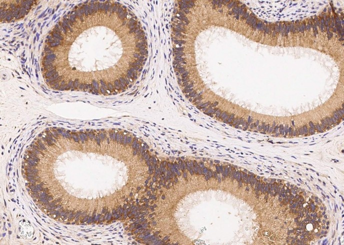 ERN1/IRE1 Monoclonal Antibody - small - 3