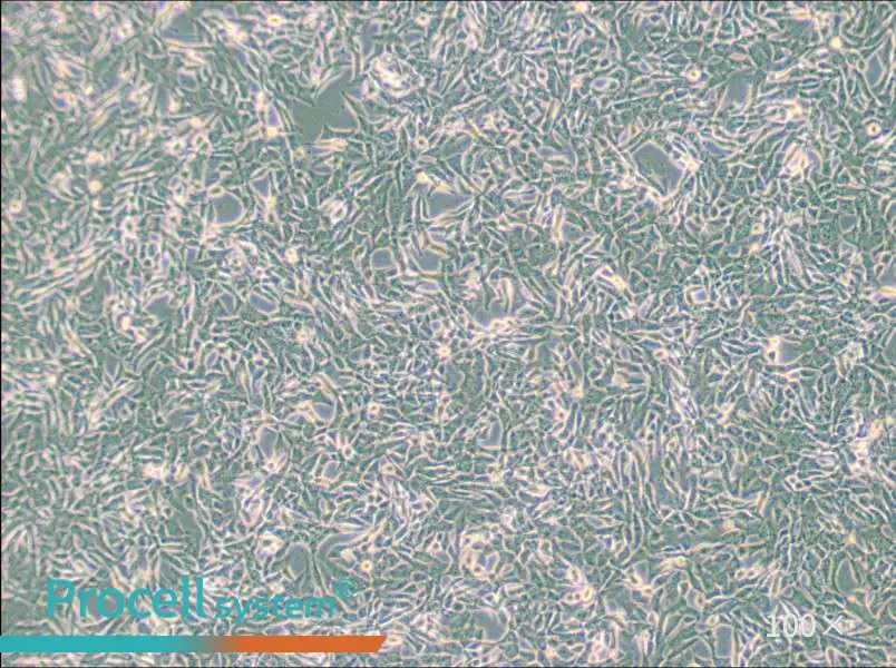 SUM159PT Cell Complete Medium - 1