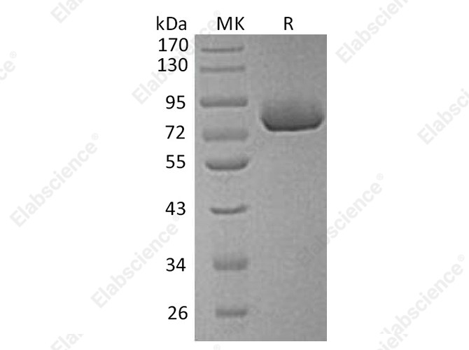Recombinant Human Osteopontin/SPP1 Protein (His Tag) - 1
