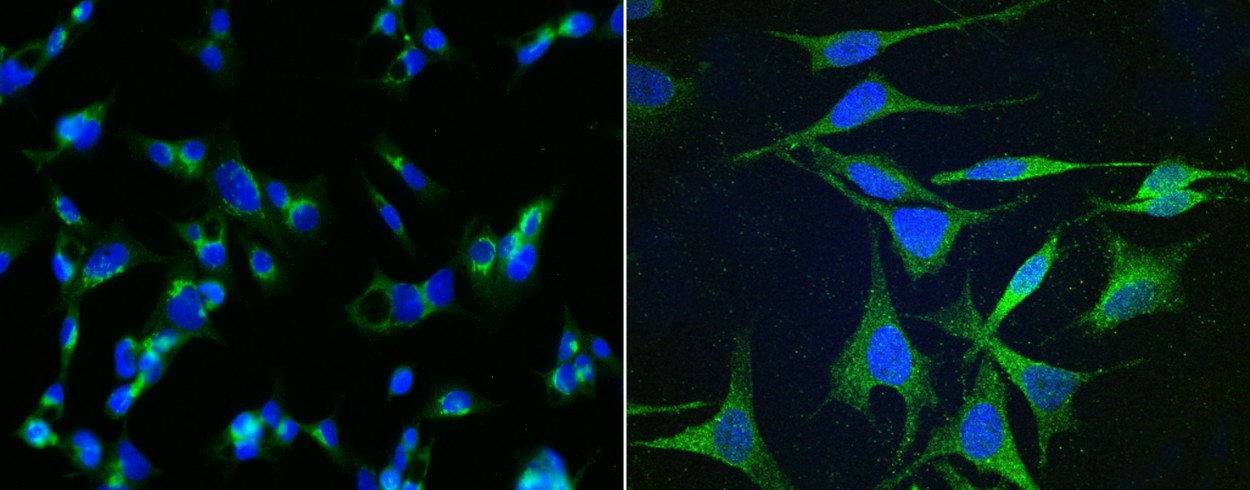 Apolipoprotein H/APOH Monoclonal Antibody-searchlist-1