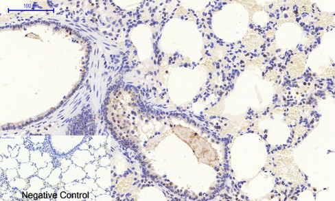 Immunohistochemistry of paraffin-embedded Rat lung tissue with Phospho-Stat1 (Tyr701) Polyclonal Antibody at dilution of 1:200