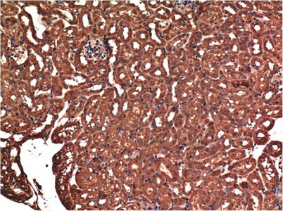 Immunohistochemistry of paraffin-embedded Mouse kidney tissue using Bax Monoclonal Antibody at dilution of 1:200.