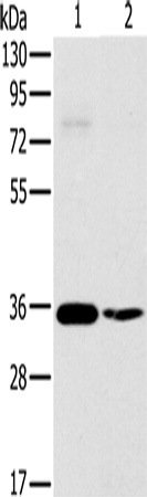 Western Blot analysis of 293T and skov3 cell using OTUB1 Polyclonal Antibody at dilution of 1:570