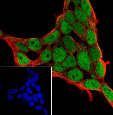 Recombinant p60 CAF1/MPP7 Monoclonal Antibody - small - 3