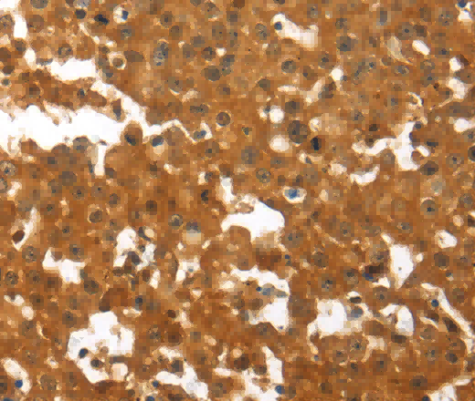TNFRSF11B Polyclonal Antibody - 3