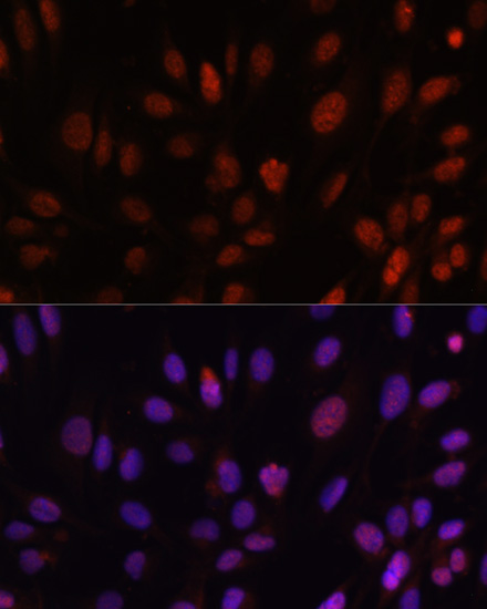 Immunofluorescence analysis of U-2 OS cells using HOXB1 Polyclonal Antibody at dilution of  1:100. Blue: DAPI for nuclear staining.