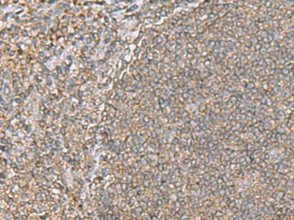 Immunohistochemistry of paraffin-embedded Human tonsil tissue  using ARF5 Polyclonal Antibody at dilution of 1:55(?200)